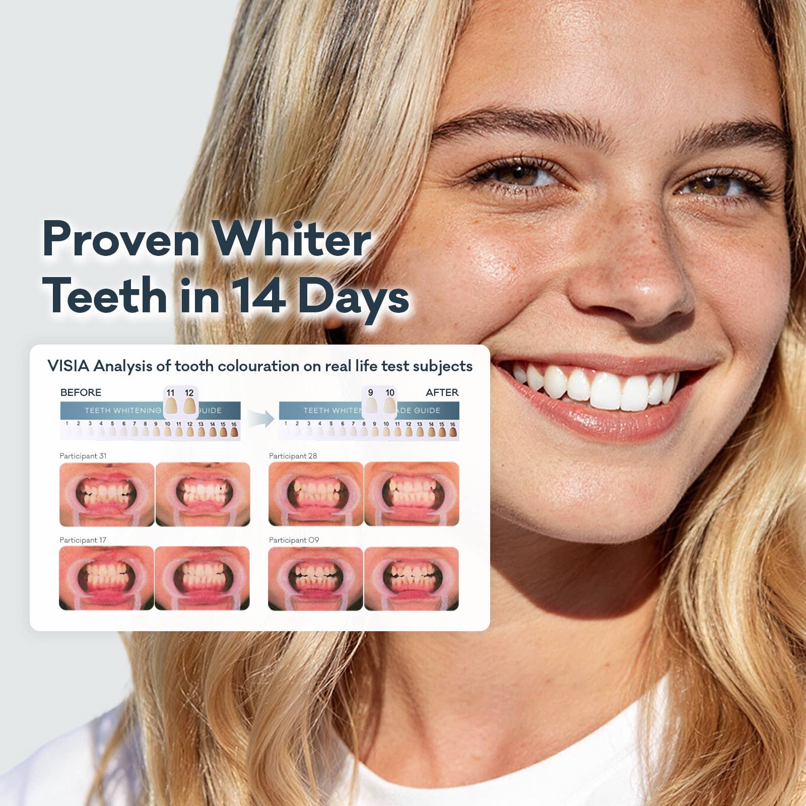 SEEN Enzyme Whitening Toothpaste | N-HA Formula, NZ Made